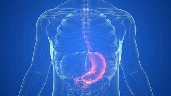 What is a gastrointestinal stromal tumor?