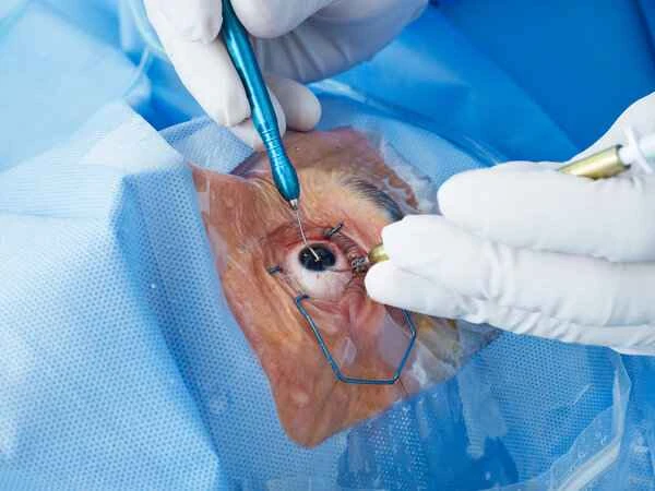 Does minimally invasive surgery for intestinal polyps require pathological examination?