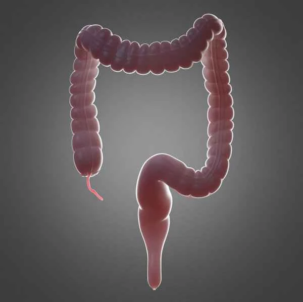 Is surgery for redundant sigmoid colon painful?