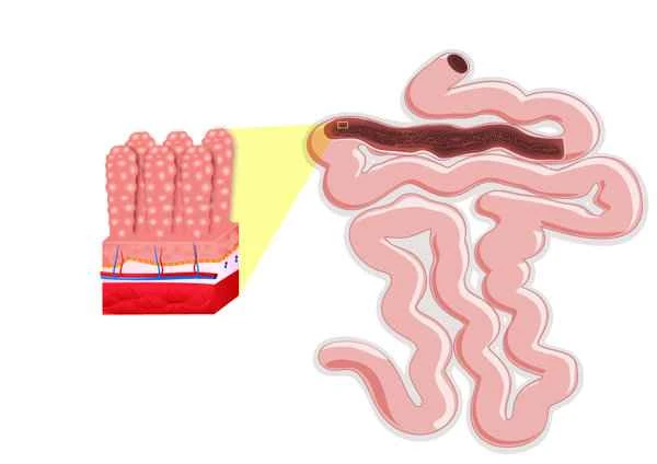 What foods can prevent intestinal obstruction?