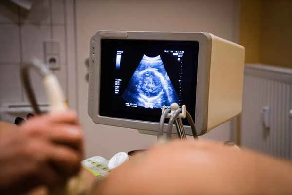 How much does a color Doppler ultrasound cost for intestinal obstruction in young children?