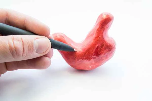 Can stomach cancer develop into esophageal cancer?