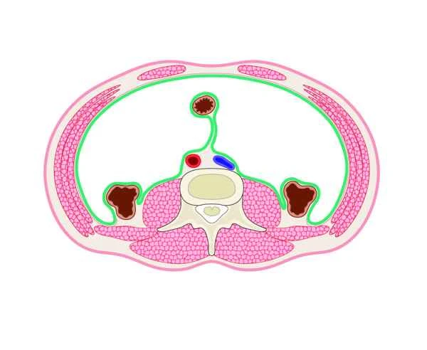 What department treats abdominal adhesions?