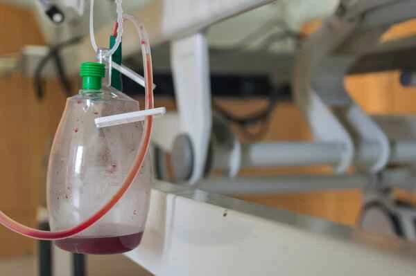 Is postoperative gastrointestinal bleeding due to improper procedure?