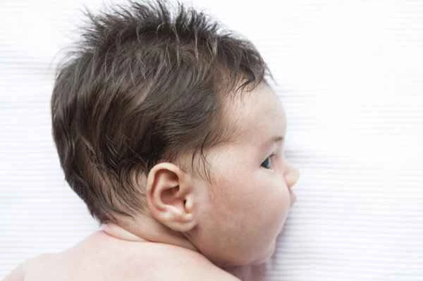 Is intestinal obstruction serious in a 70-day-old baby?